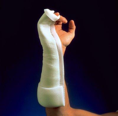 one-step-splint.jpg